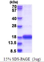 Human C11orf31 / SELH Protein (Recombinant His)