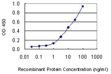 KRT1 / CK1 / Cytokeratin 1 Antibody (clone 2A7)