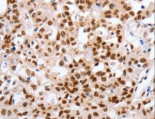 Polyclonal Rabbit anti-Human MUTYH / MYH Antibody (IHC, WB)