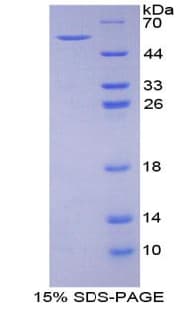 Mouse AATF Protein (Recombinant His-GST)