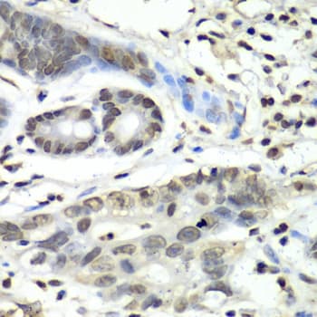 Polyclonal Rabbit anti-Human HIF1AN Antibody (IHC, IF, WB)