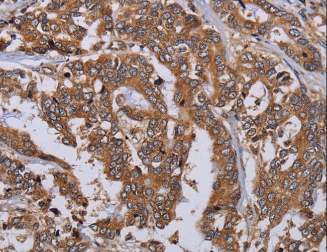 MFAP3L / NYD-Sp9 Antibody
