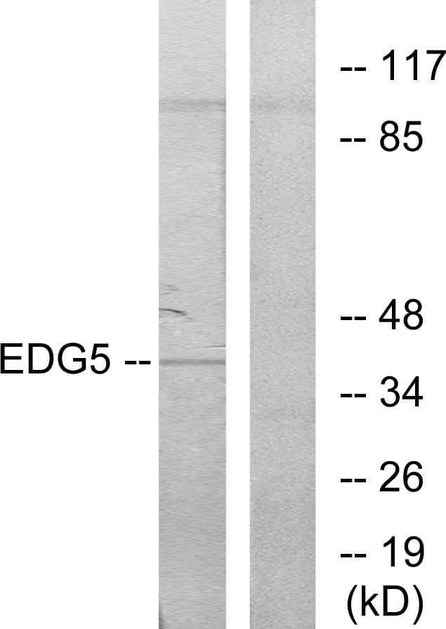 SIPR2 / S1P2 / EDG5 Antibody (C-Terminus)