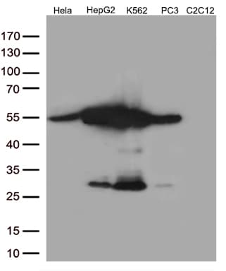 Monoclonal Mouse anti-Human CALR / Calreticulin Antibody (clone OTI6H10, WB)