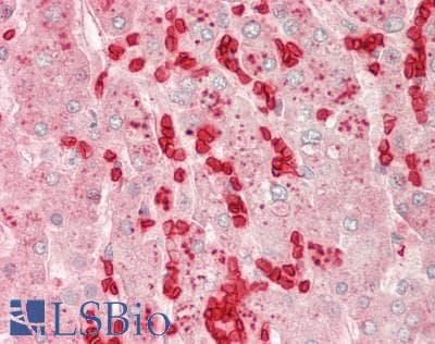IHC-plus™ Polyclonal Goat anti-Human Hemoglobin Antibody (IHC, WB)