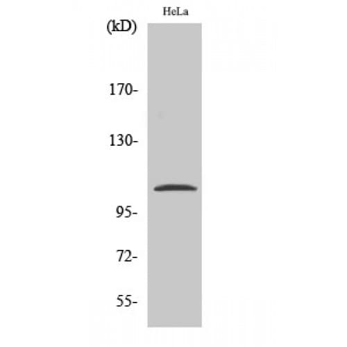 Polyclonal Rabbit anti-Human NFKB1 / NF-Kappa-B Antibody (870-950 aa, IHC, WB)