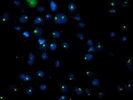 PGAM2 Antibody (clone OTI1C2)