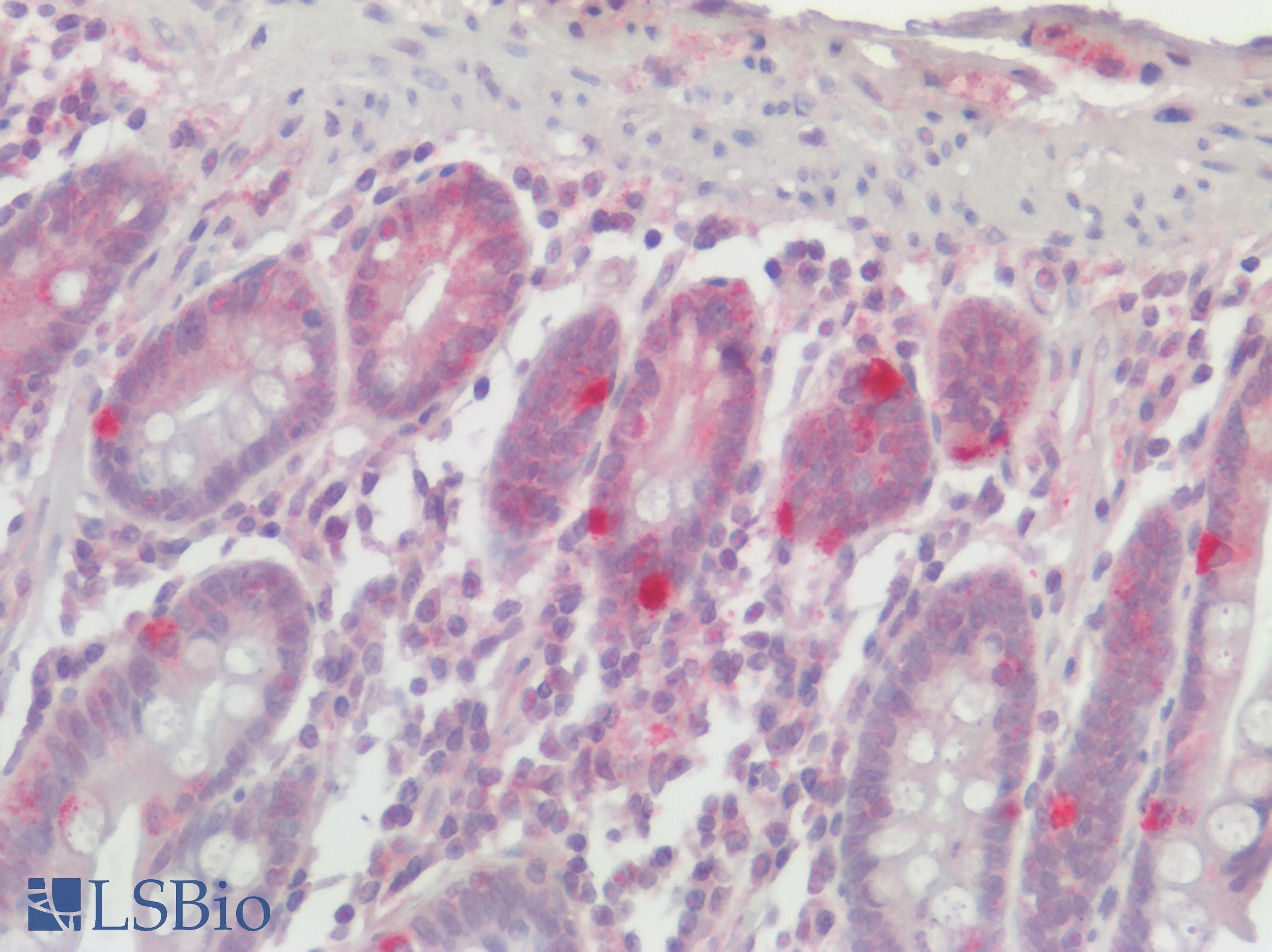 IHC-plus™ Polyclonal Rabbit anti-Human GPR75 Antibody (N-Terminus, IHC)