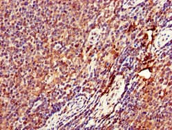 Polyclonal Rabbit anti-Human DENND1C Antibody (IHC, WB)