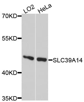 Polyclonal Rabbit anti-Human SLC39A14 / ZIP14 Antibody (WB)