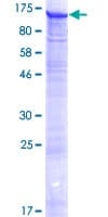 Human CMTR1 / FTSJD2 Protein (Recombinant GST)