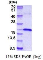 Human IL17B Protein (Recombinant His)