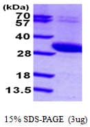 Human UCK2 Protein (Recombinant His)