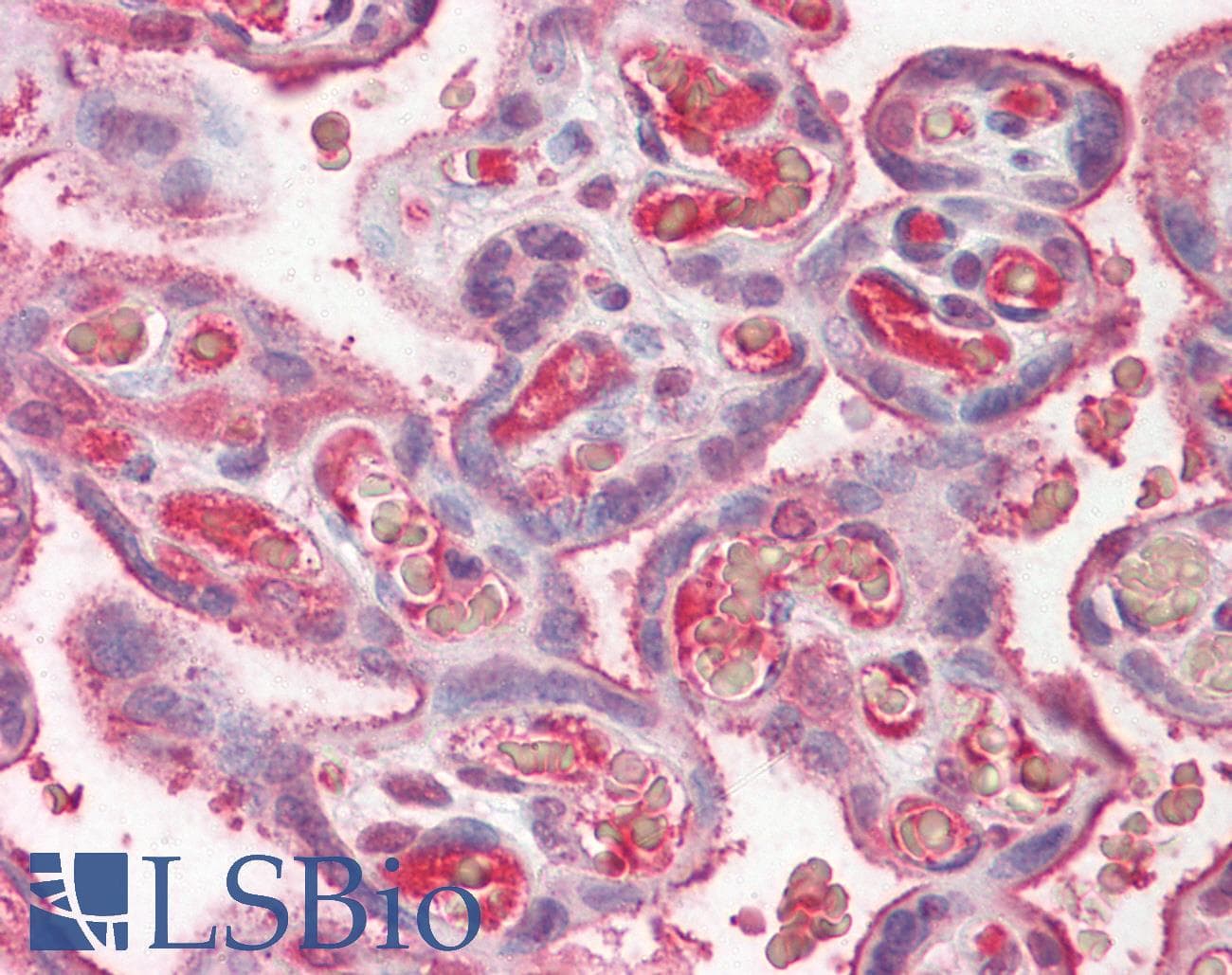 IHC-plus™ Polyclonal Rabbit anti-Human CP / Ceruloplasmin Antibody (IHC, IF, WB)