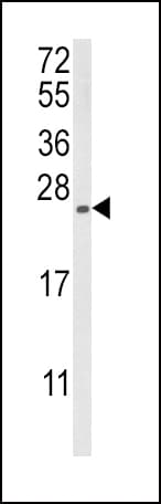 RGS4 Antibody (aa147-174)