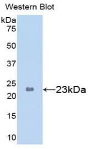 PYGL Antibody (aa633-820, Biotin)