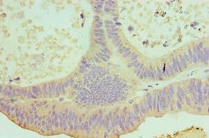 IL22 Antibody (aa34-179)