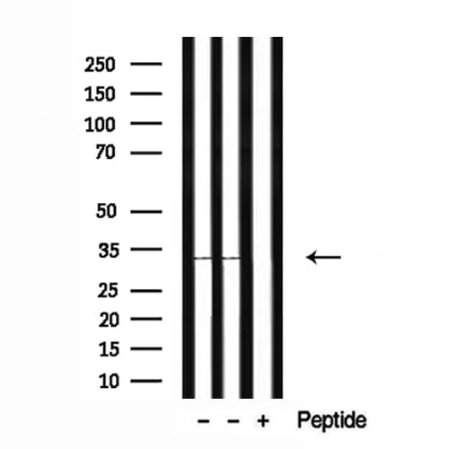 CYB5R2 Antibody