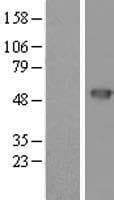 CYTH4 / PSCD4 Protein (Over-Expression Lysate Myc-DDK (Flag))
