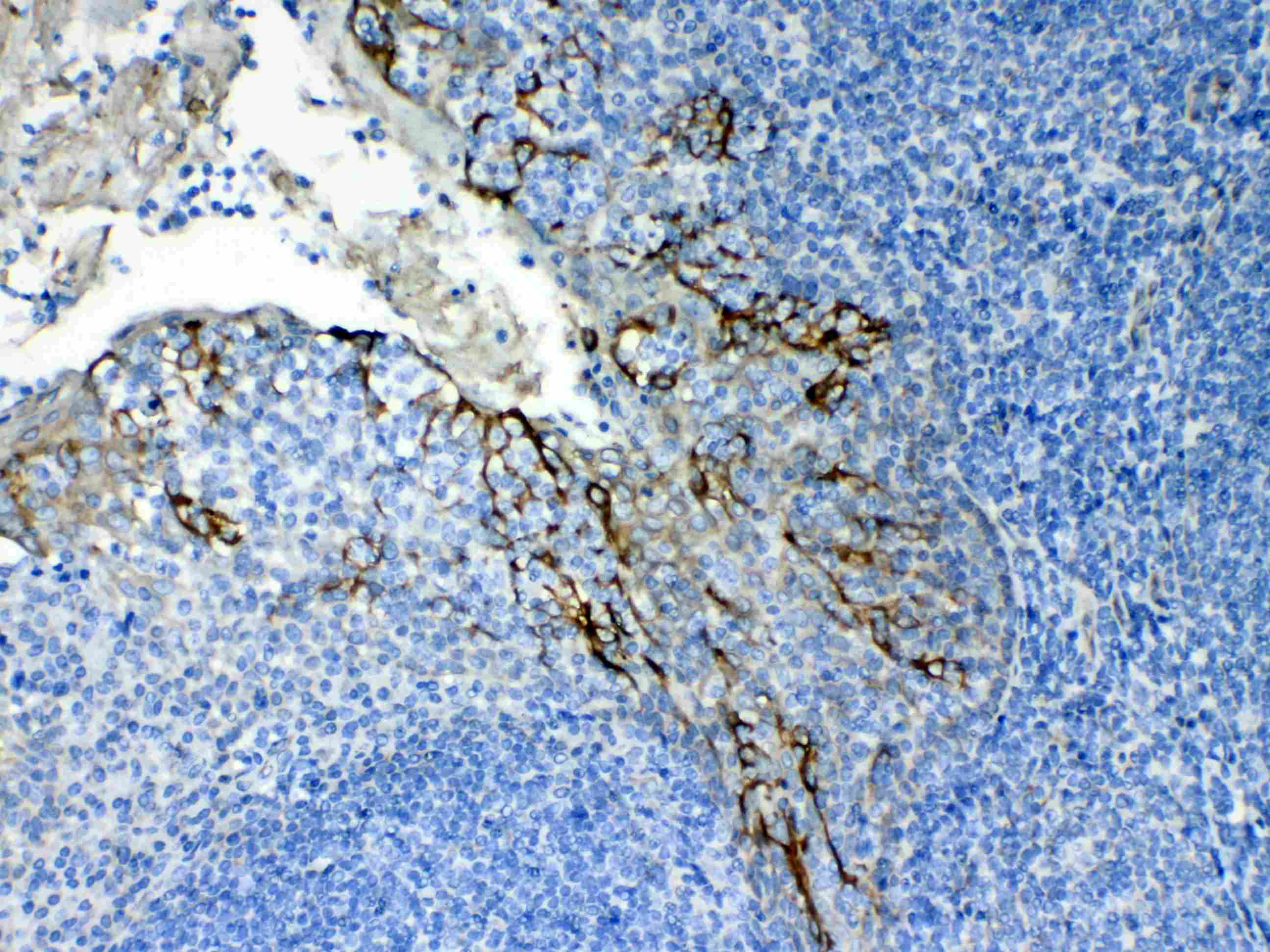 KRT8 / CK8 / Cytokeratin 8 Antibody