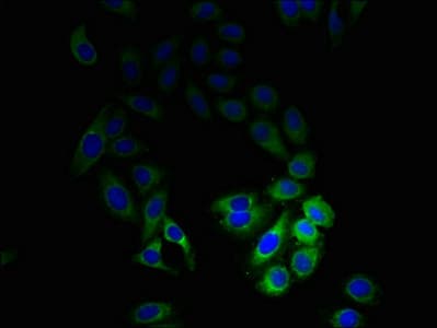 Polyclonal Rabbit anti-Human M6PR Antibody (WB)