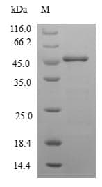 Staphylococcus aureus ACPP / PAP Protein (Recombinant GST, N-terminus)