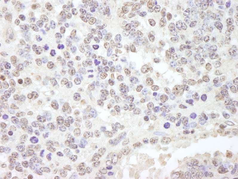 USP47 Antibody (aa1237-C-term)