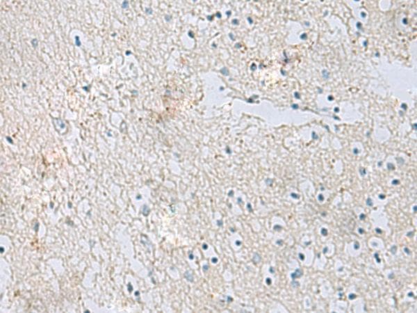 Polyclonal Rabbit anti-Human RDH1 / RDH5 Antibody (IHC)