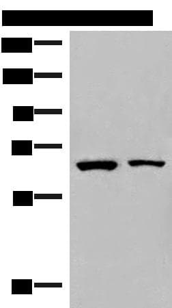 ZNF85 / HPF4 Antibody