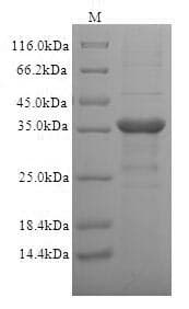 Human CD1C Protein (Recombinant 6His, N-terminus)