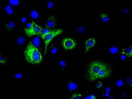 IHC-plus™ H6PD / G6PDH Antibody (clone 1H6)