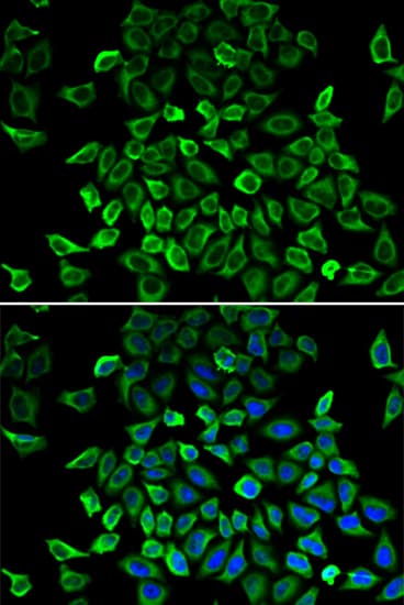 Polyclonal Rabbit anti-Human BCL2L13 / Bcl Rambo Antibody (IHC, IF, WB)