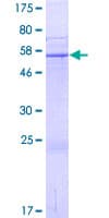 Human SUSD3 Protein (Recombinant GST)