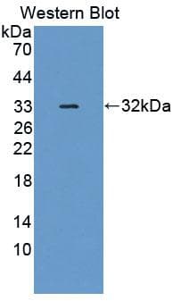 MAP1B Antibody
