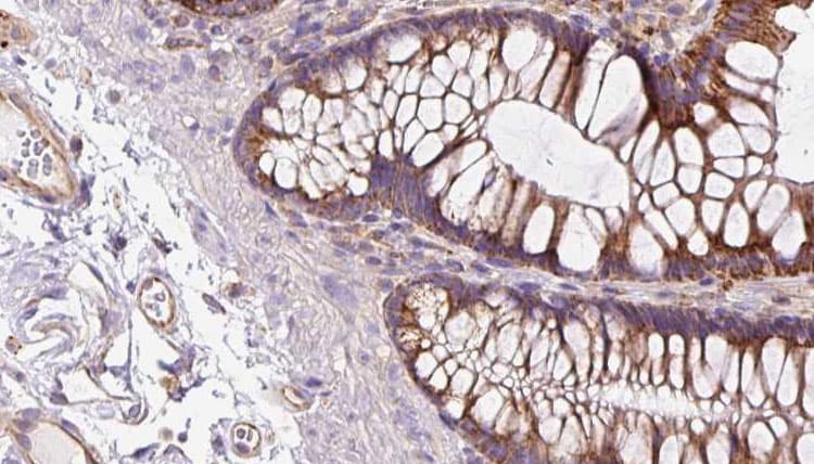 Polyclonal Rabbit anti-Human NOD2 / CARD15 Antibody (IHC, IF, WB)