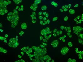 CRYAB / Alpha B Crystallin Antibody (clone OTI6A9)