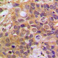 Polyclonal Rabbit anti-Human DAXX Antibody (Internal, IHC, IF, WB)