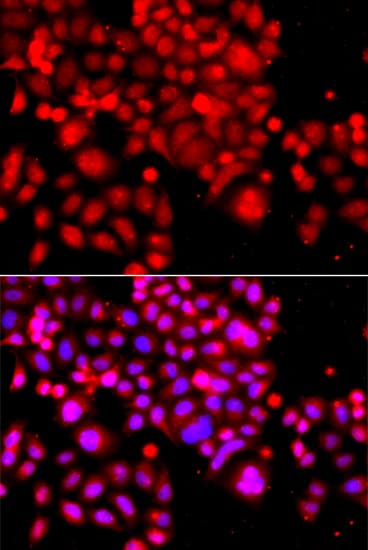 Polyclonal Rabbit anti-Human ASCC3 Antibody (IF, WB)