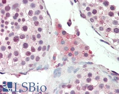 IHC-plus™ PRKAG1 / AMPK Gamma 1 Antibody (aa230-331, clone 7H3E9)