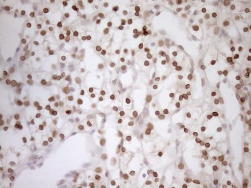 MED15 / ARC105 Antibody (aa393-679, clone OTI1C11)