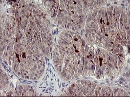 MMP13 Antibody (aa104-471, clone OTI1G5)