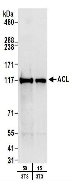 IHC-plus™ ACLY / ATP Citrate Lyase Antibody (aa350-400)
