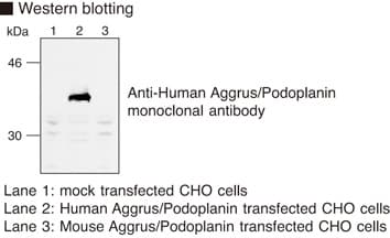 PDPN / Podoplanin Antibody (clone YM-1)