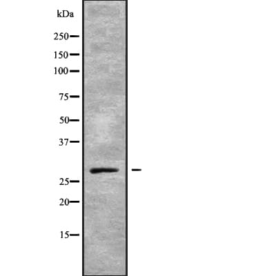 Polyclonal Rabbit anti-Human GTPCH1 / GCH1 Antibody (WB)