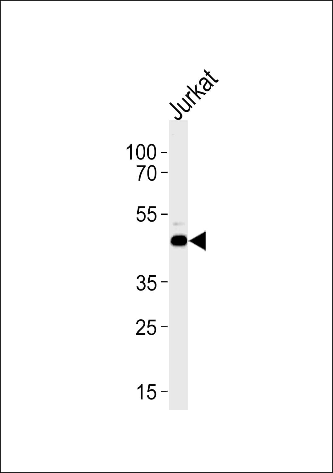 APG4B / ATG4B Antibody (aa250-290)