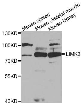 LIMK2 Antibody
