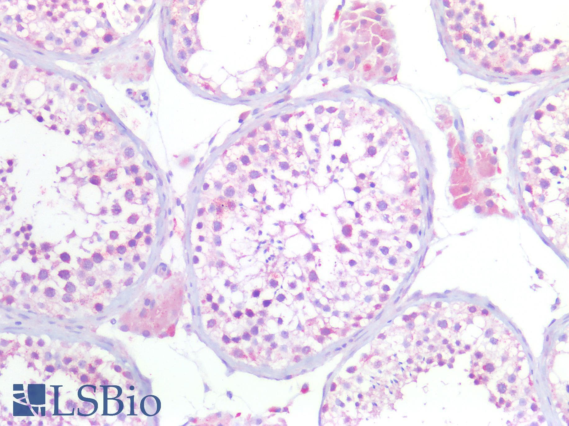 PathPlus™ CCNE1 / Cyclin E1 Antibody (aa91-140)
