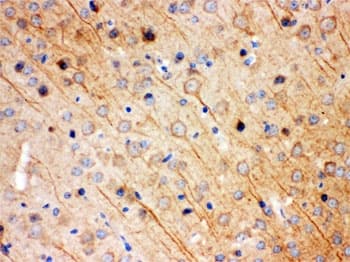 Polyclonal Rabbit anti-Human KCNIP2 / KCHIP2 Antibody (IHC, WB)