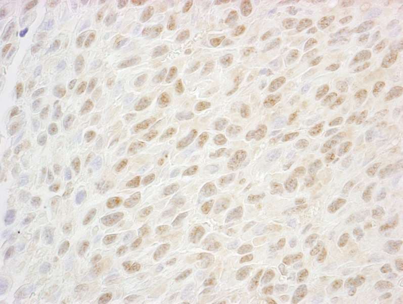 NABP2 Antibody (aa161-211)