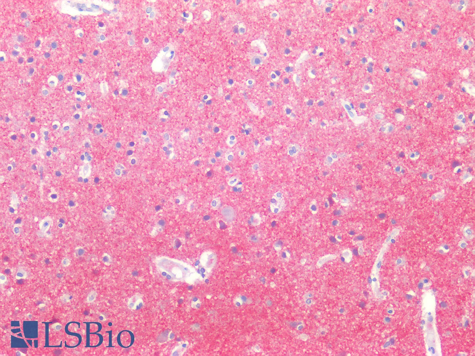 PathPlus™ SNCA / Alpha-Synuclein Antibody (aa61-95, clone 10C299)
